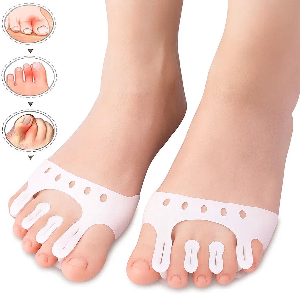 Silicone Toe Corrector 5-Hole | Toe Spreader | Hallux Valgus | Straighten Toes | Shock Absorbing | With Holes | White | 1 Pair