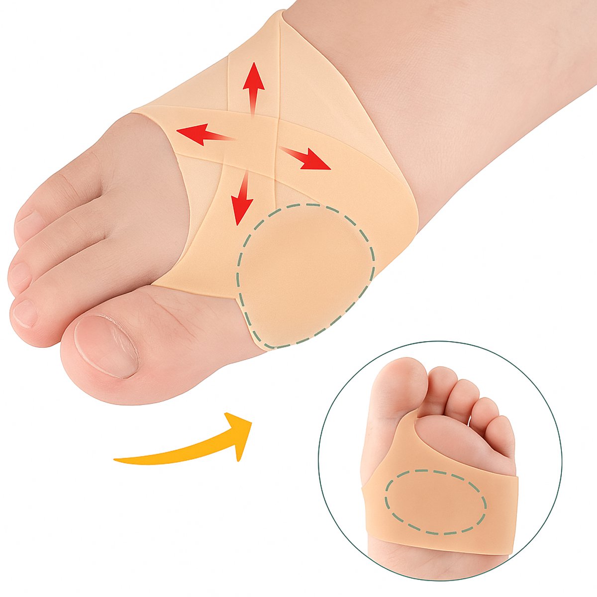 Hallux Valgus Silicone Toe Protectors | Toe Separators | Toe Corrector | Bunion | Bunion | Callus | Toe Straightening | 1 Pair | Beige
