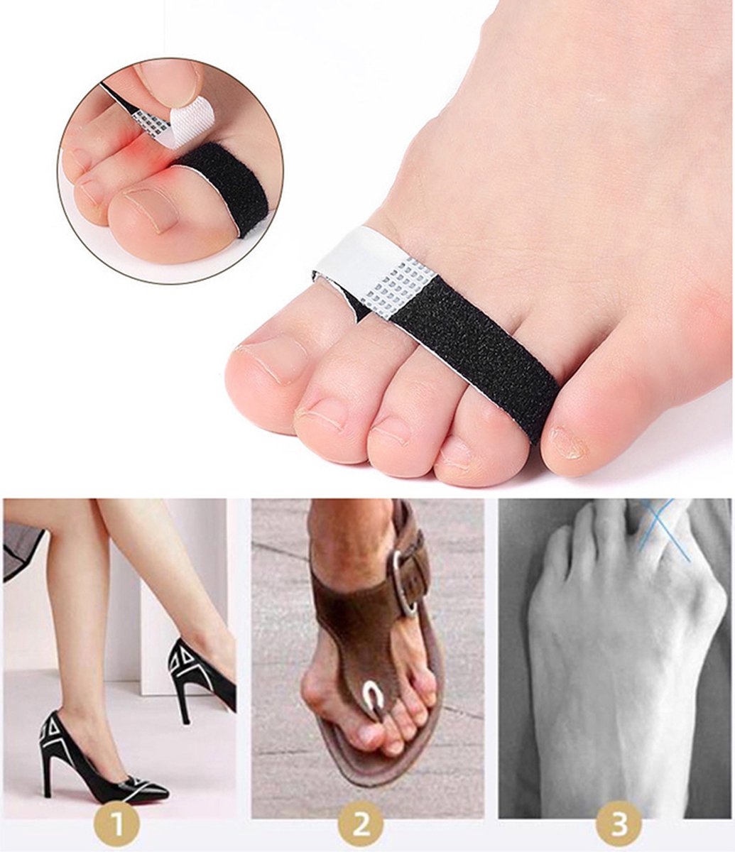 Toe Brace I Toe Bandage I Finger Brace I Finger Bandage I Toe And Finger Corrector I Toe Wrap I 1 Pair I White
