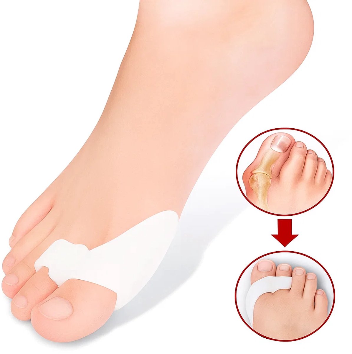 Silicone Toe Corrector | Toe Spreader | Hallux Valgus | Big and Little Toe Protector | 1 Pair