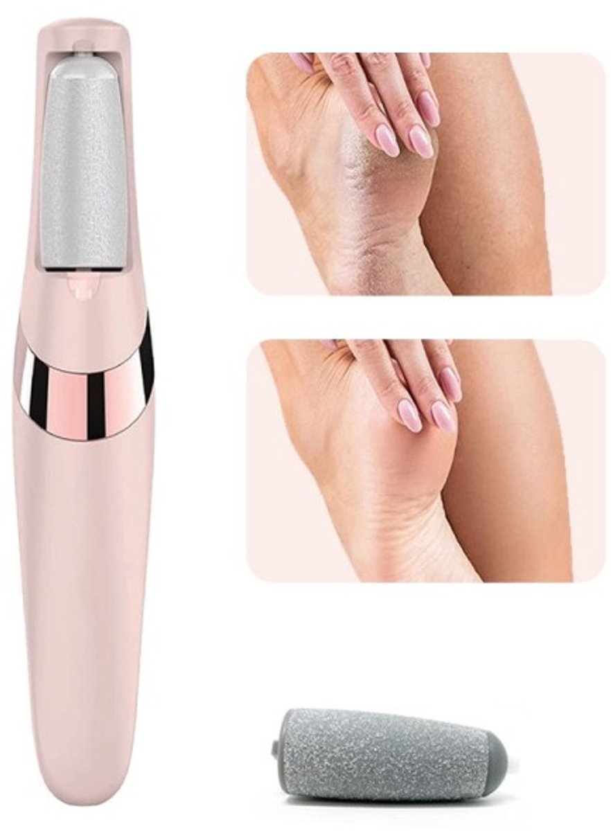 Foot Repair - Rechargeable Electric Callus Remover - Removes Dry Skin - For Smoother Feet