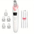 Blackhead Cleansing Device: 5 Nozzles for Full Face, 3 Suction Levels for Targeted Cleansing