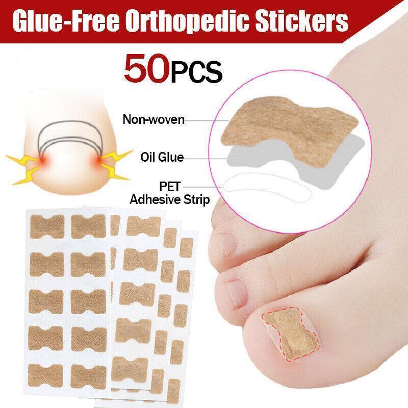 50-100Pcs Glue Free Toenail Toe Ingrown Nail Correction Patch Sticker Foot Care - 50PCS