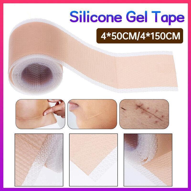 Silicone Gel Tape Scar Removal Self-Adhesive Efficient Scar Removal Patch Tapes - 4*150CM