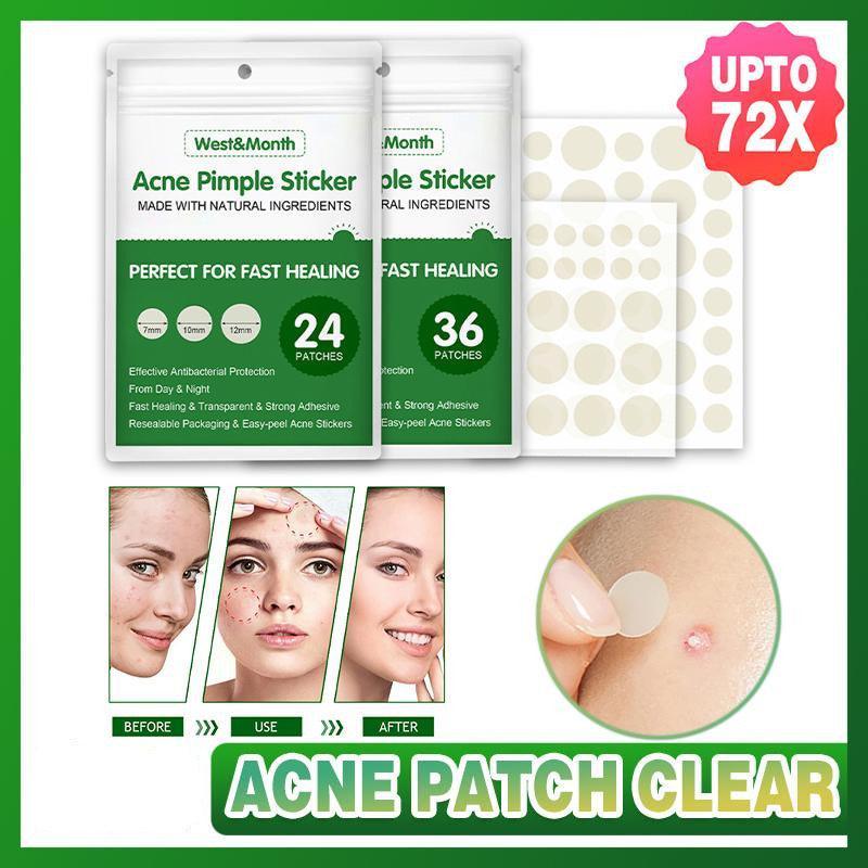 Skin Tag Remover Acne Pimple Patch Removal Facial Care Spot Plaster - 24 PCS